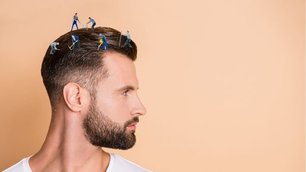 matu atkāpšanās gadījumā matu transplantācija