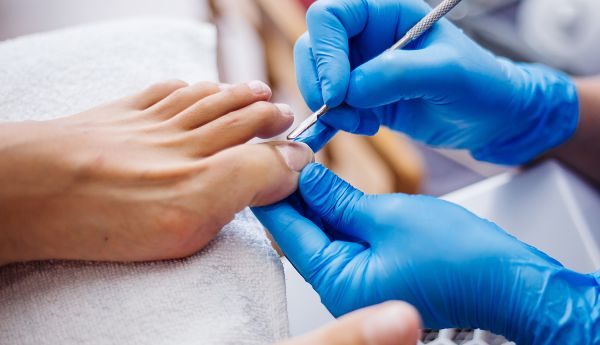 Kāju nagi maina krāsu, plaisā pēdas, kārpas